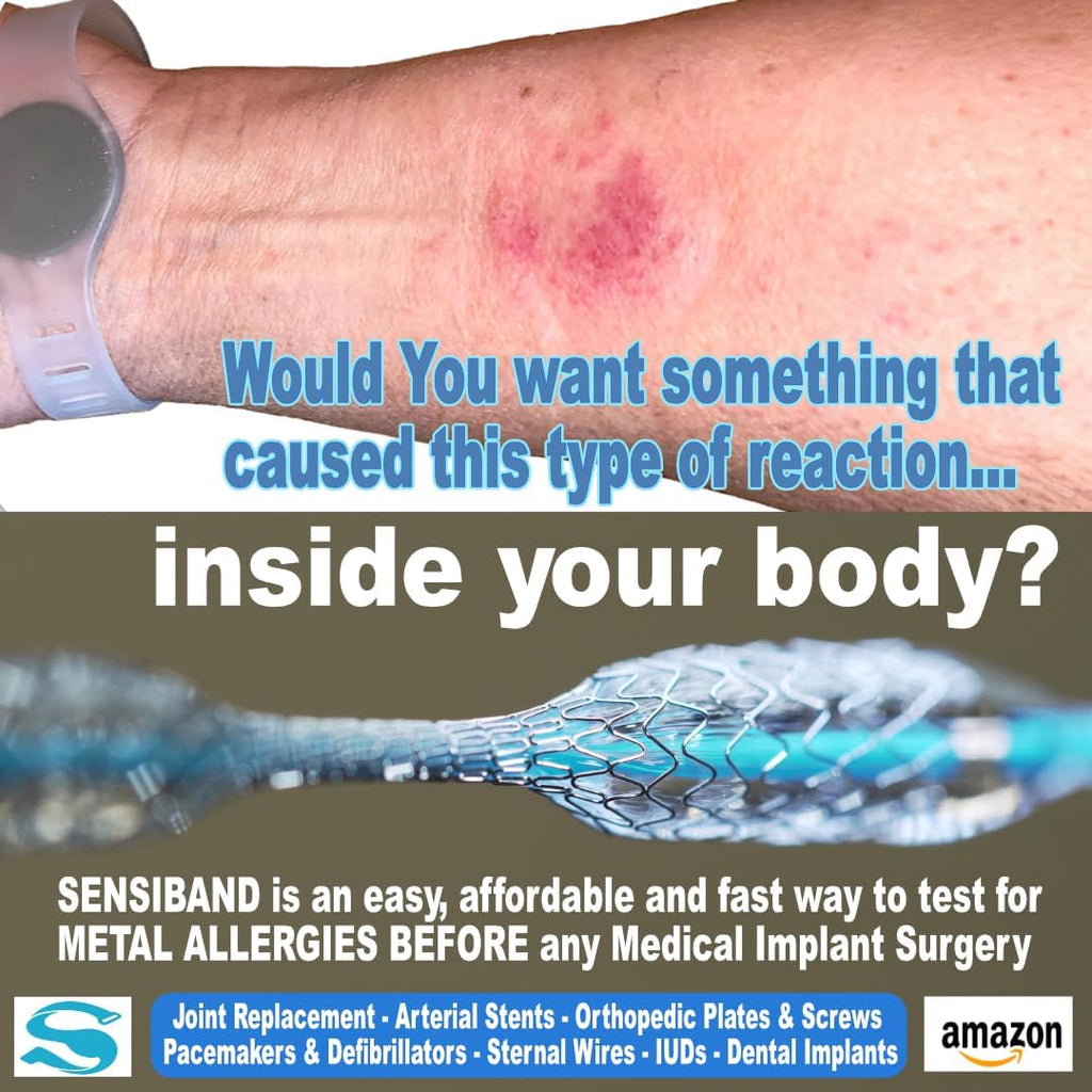 Metal Allergy Test Band for Piercings and Jewelry P197